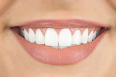 Root Canal Root Canal