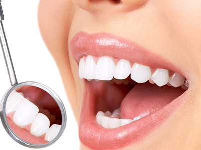 Fillings Lahore