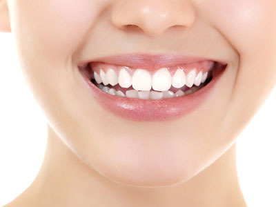 Teeth Whitening Lahore